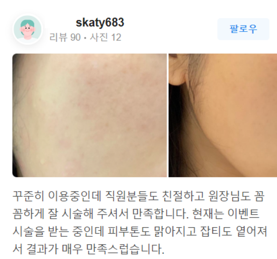 남자입술필러 자연스럽게 잘생겨지는 비결! 관련 이미지 6