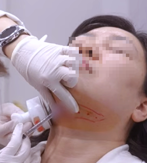 홍대 윤곽주사 효과 올리는 3가지 방법 관련 이미지 3