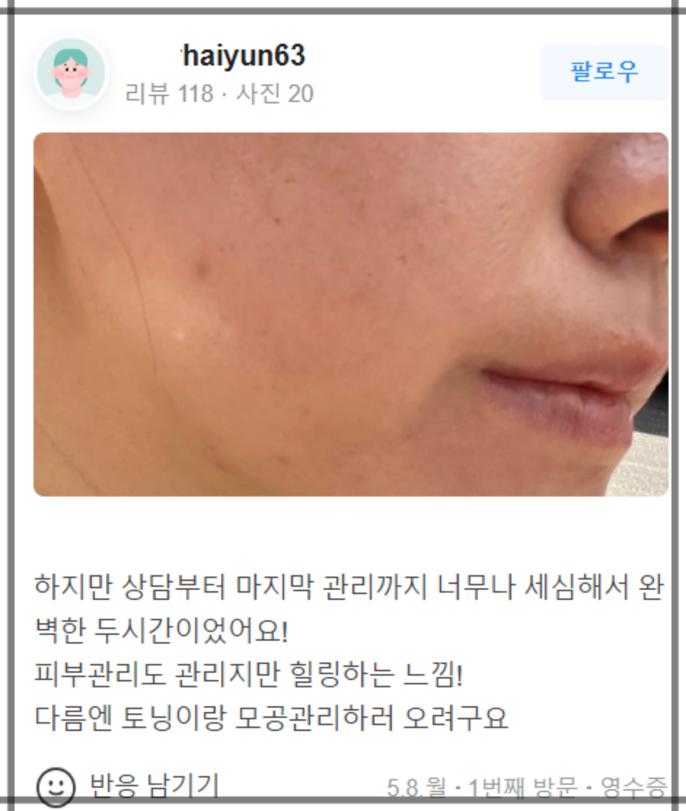 합정 입술필러유명한곳 찾아가는 이유! 관련 이미지 18