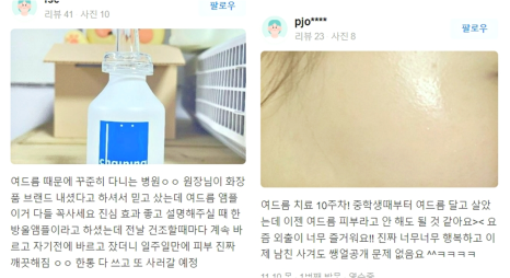 목리프팅 목주름을 확실하게 없애고 싶은 분들만 꼭 보세요. 관련 이미지 10