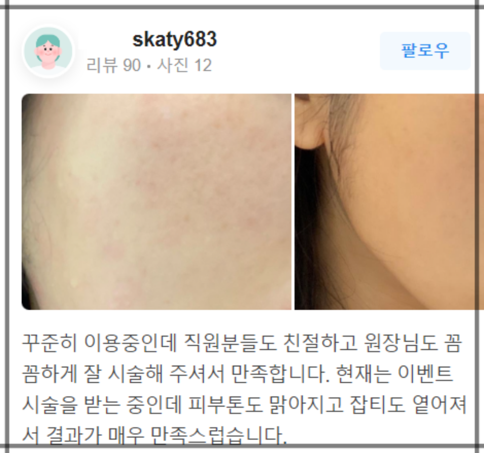합정 입술필러유명한곳 찾아가는 이유! 관련 이미지 12