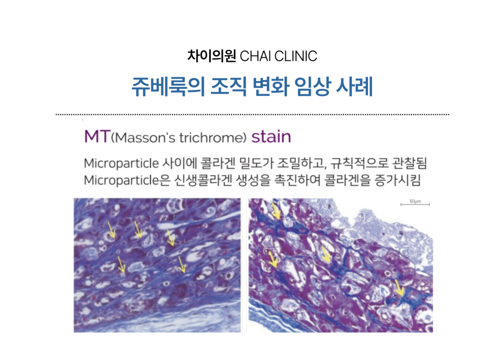 리쥬란 쥬베룩의 차이와 효과의 시너지에 대해 관련 이미지 6