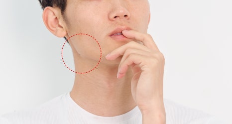 남자턱보톡스 OOO을 고려해야 관련 이미지 5