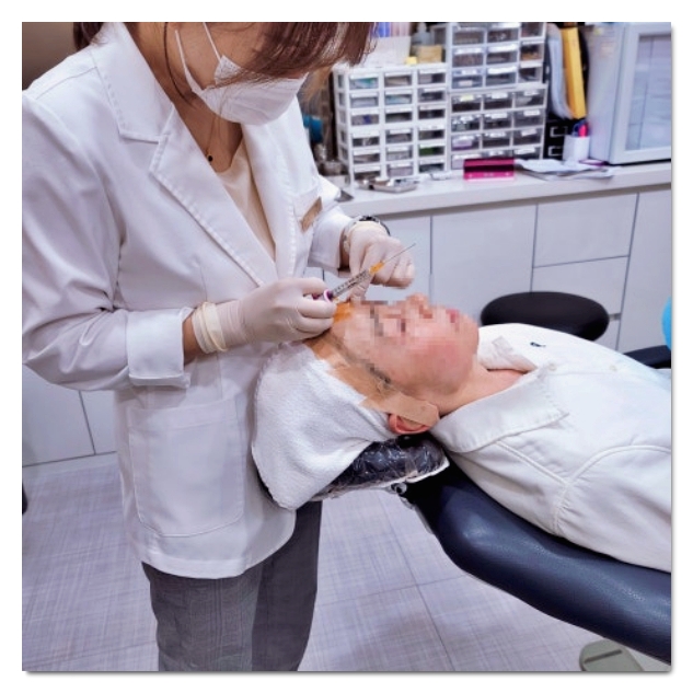 How to Consult So You Can Avoid Filler Side Effects in Hapjeong image 5
