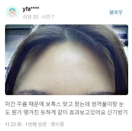 얼굴실리프팅가격 보다 관련 이미지 15