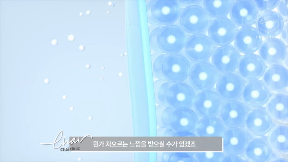 Hongdae Thermage: Safety and Satisfaction Proven by More Than 10 Years of Accumulated Data image 9