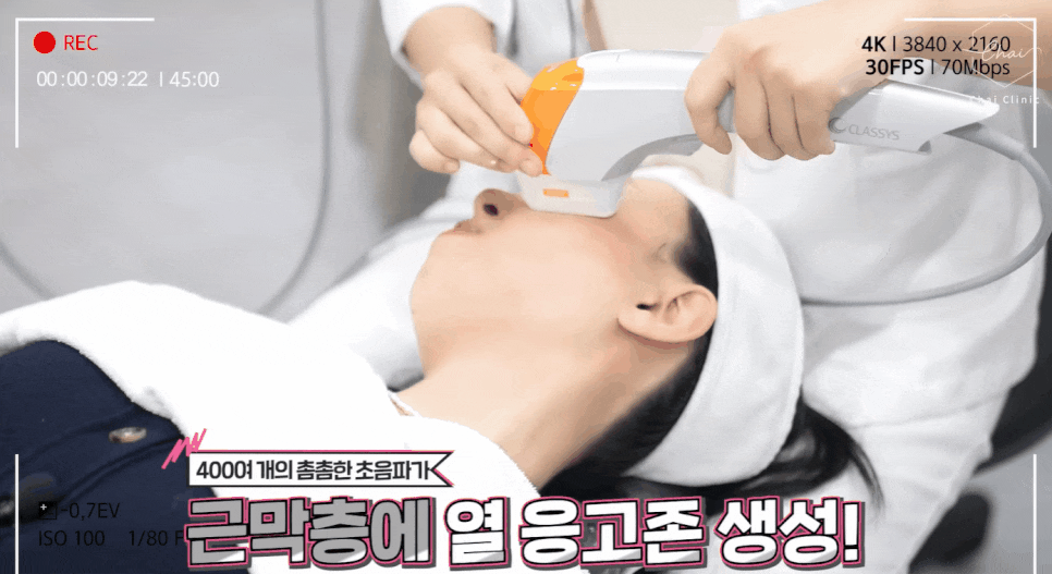 얼굴살시술 매끈하고 예쁜 라인으로 돌아가는 방법 관련 이미지 5