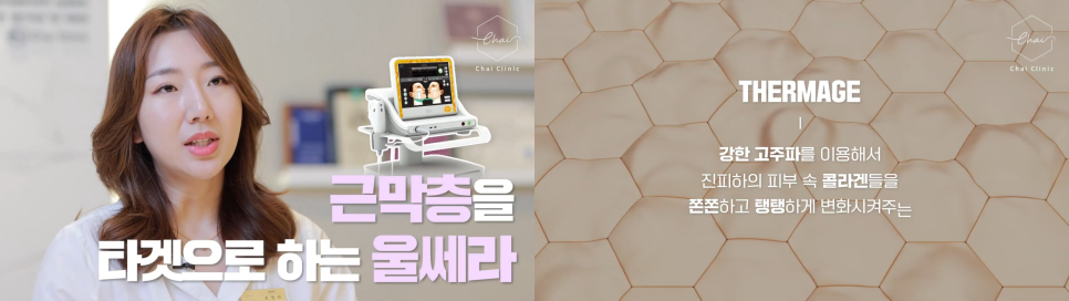 연남동피부관리 울쎄라, 써마지... 정답은 울써마지? 관련 이미지 3