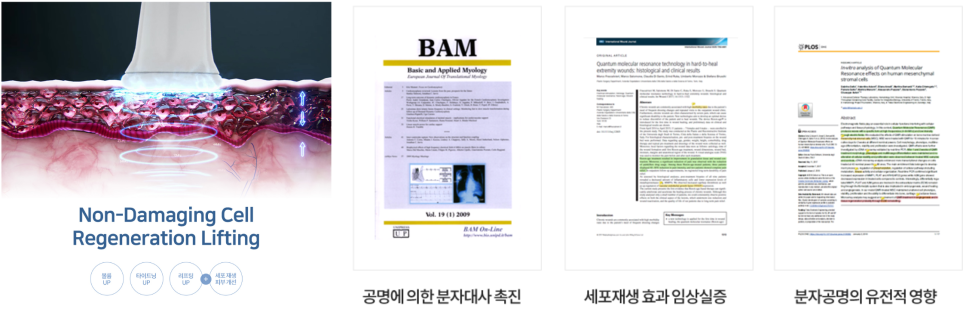 리쥬란 HB 효과와 부작용, 통증, 유지기간 총망라! 관련 이미지 5
