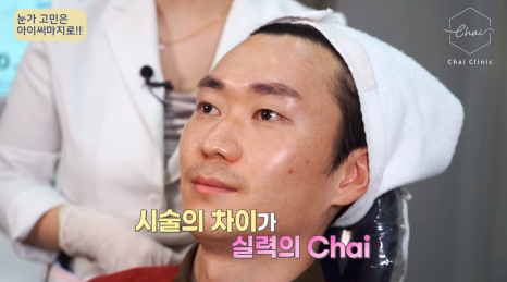 아이써마지 효과, 처진눈 잡는 4세대 장비 아시나요? 관련 이미지 9