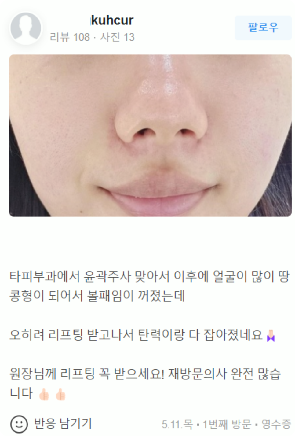 홍대피부관리 떨어지는 피부 탄력 확실하게 리프팅 하는 비결 (근처10분거리) 관련 이미지 19