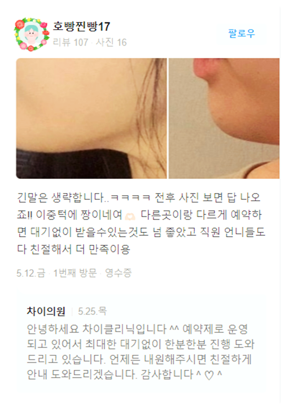 목주름레이저 타임머신효과, 탄력있는 목을 유지하세요! 관련 이미지 19