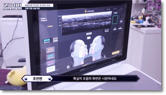 합정 울쎄라 잘하는 곳은 이것이 다릅니다 관련 이미지 6