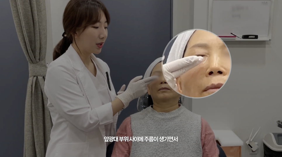 눈밑 쥬베룩 볼륨의 효과와 유지기간 관련 이미지 4
