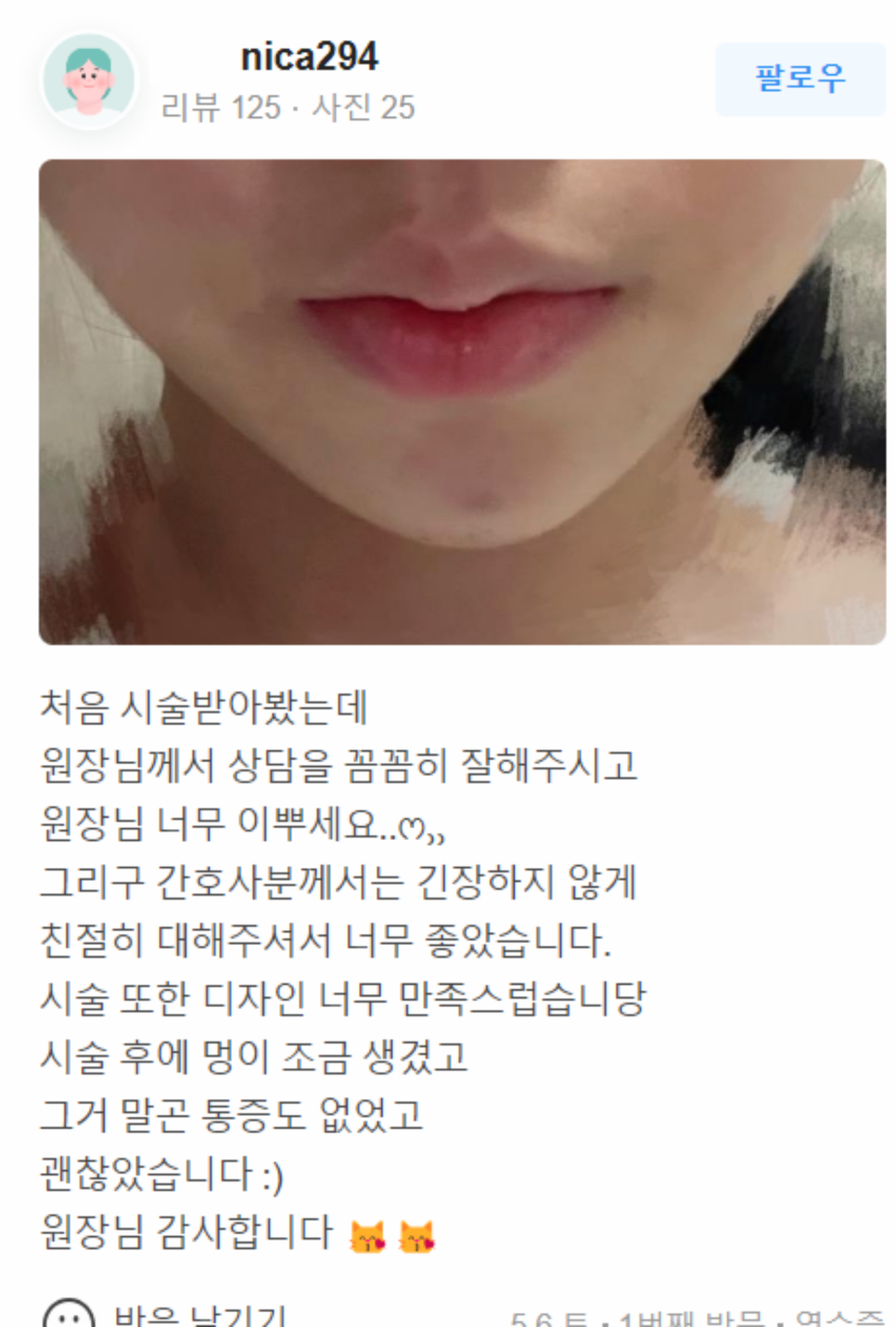 사각턱보톡스가격 보다 중요한 것 확인해 보세요! 관련 이미지 17