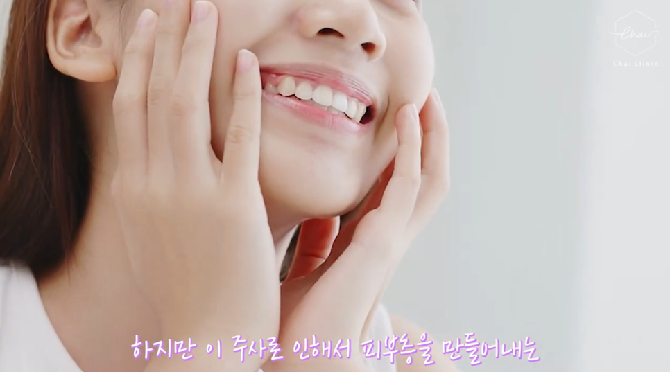 리쥬란 hb 효과, 유지기간, 통증 총정리! 관련 이미지 5