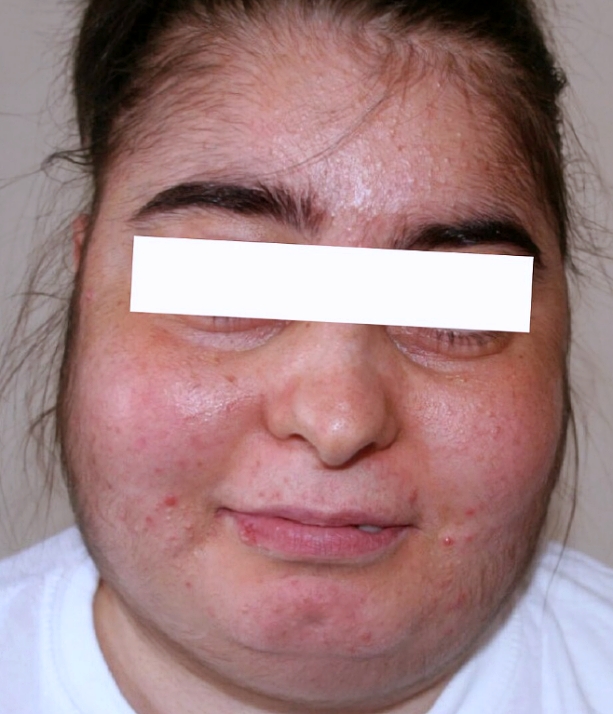 홍대 윤곽주사 효과 올리는 3가지 방법 관련 이미지 6