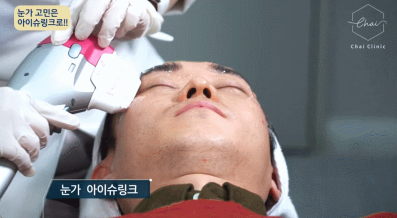 눈밑주름레이저 로 눈가 주름 고민 해결하세요 관련 이미지 7