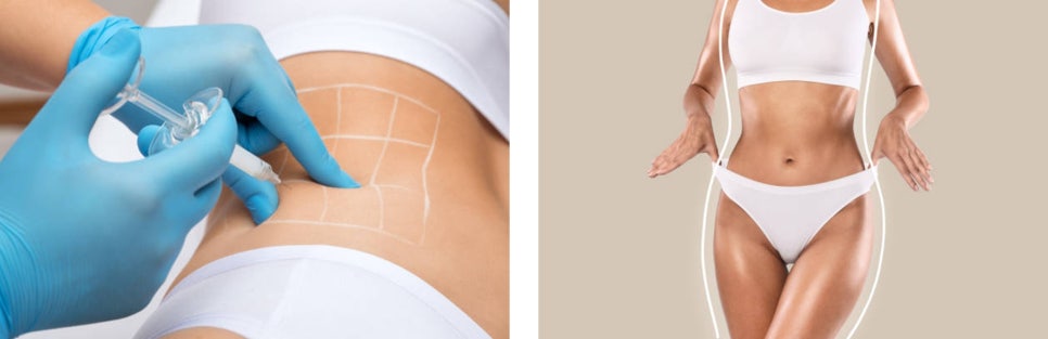 목동피부관리 간편한 여름철 몸매 관리 시술! 관련 이미지 9