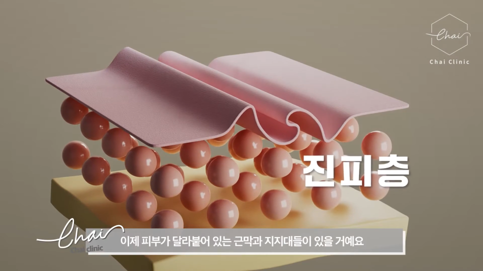 홍대 포텐자 원리와 특징 살펴보기 관련 이미지 6