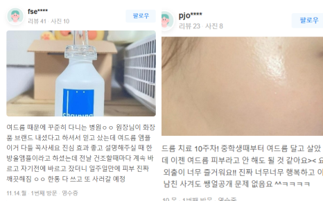 맨얼굴 걱정거리 티존 관리법, 차이닝 관련 이미지 21