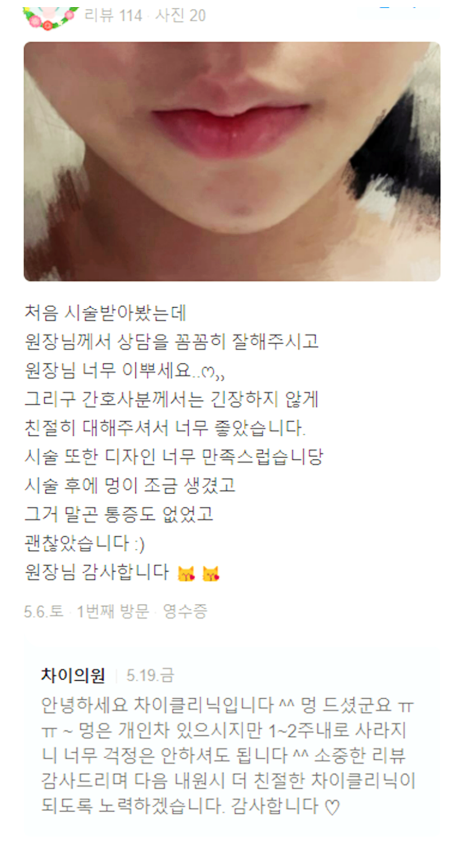 목주름레이저 타임머신효과, 탄력있는 목을 유지하세요! 관련 이미지 15