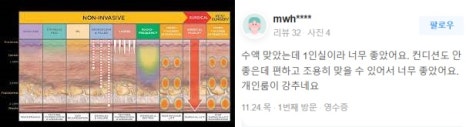 홍대여드름흉터 제거 가장 효과적인 제거 방법은? 관련 이미지 14
