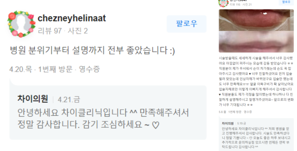 사각보톡스 불룩한 턱선을 V라인 얼굴로 관련 이미지 18