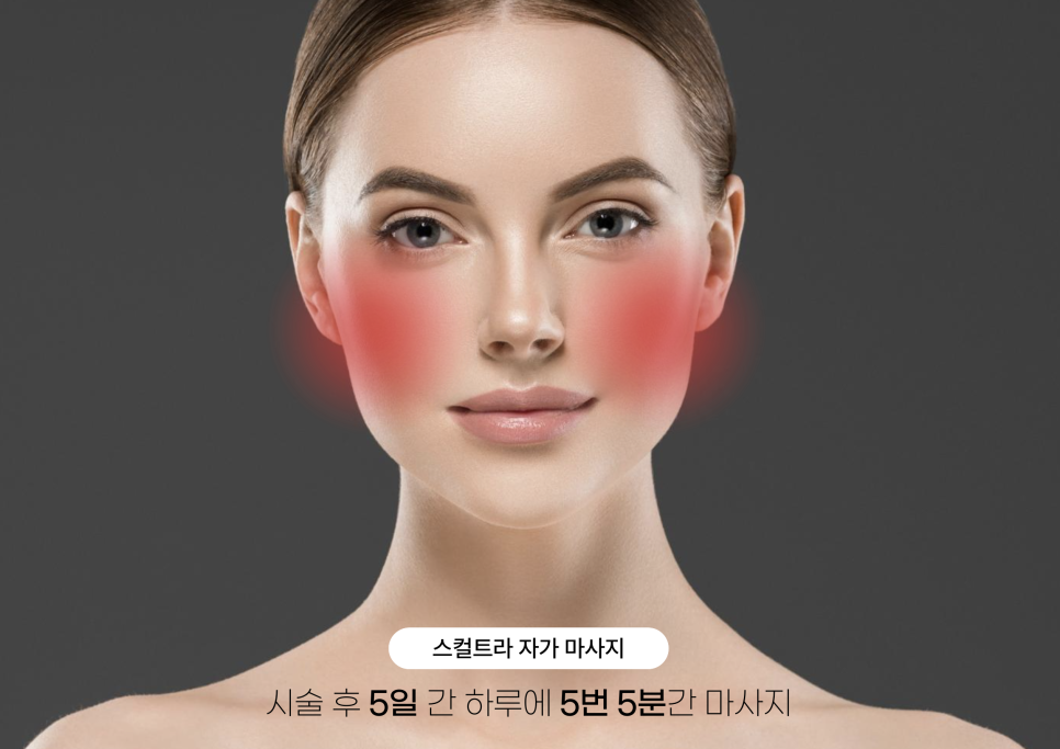 차이의원의 콜라겐 주사 종류 관련 이미지 9