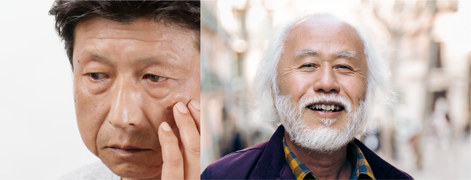 남자 팔자주름, 늦었다고 포기하지 마시고 관련 이미지 4