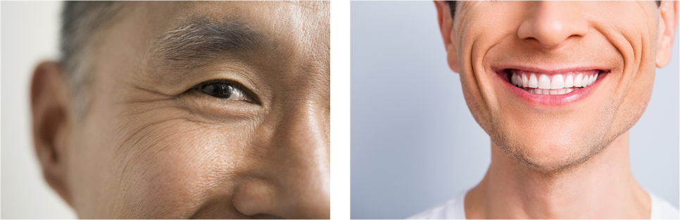 남자보톡스 101가지 궁금증 의사가 알려드립니다! 관련 이미지 3