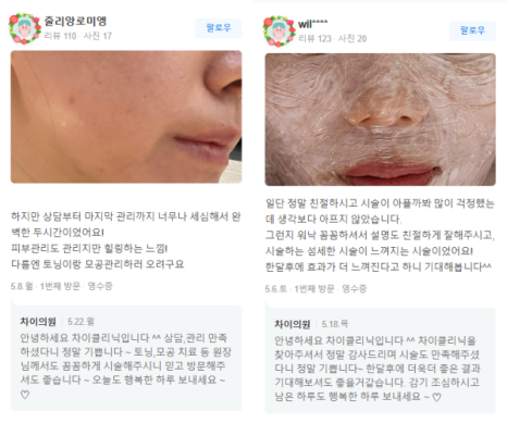 아현역피부관리 풀페이스더모톡신 주름개선 대박이네요! 관련 이미지 18