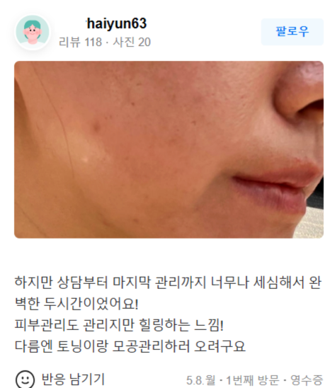 여드름 흉터 레이저, 피코프락셀과 같이 하면 좋은 것은? 관련 이미지 16