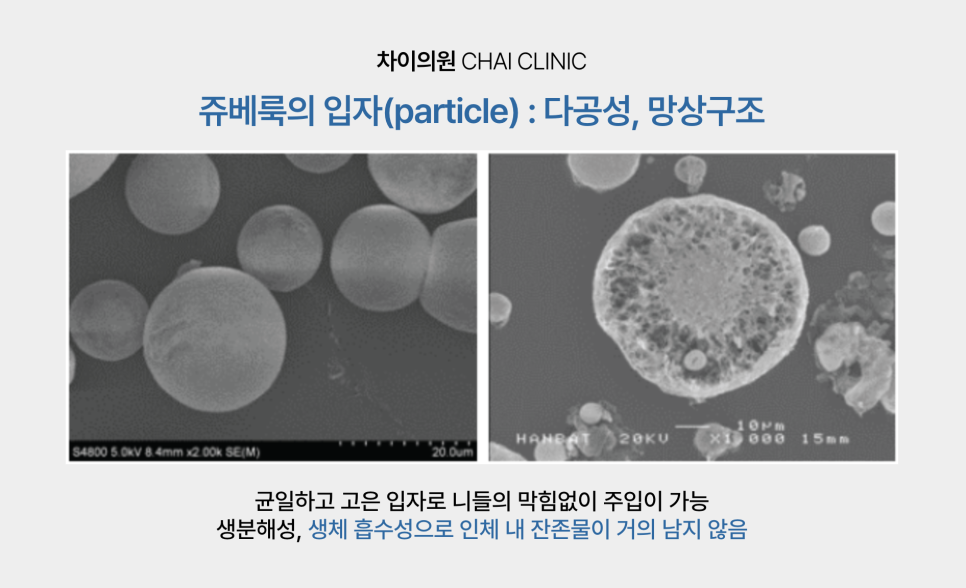 울퉁불퉁한 피부를 개선하는 쥬베룩 흉터 치료 관련 이미지 1