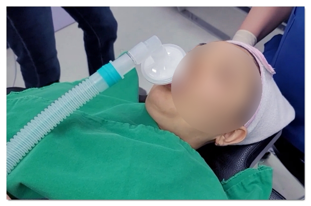 How to Decide Whether to Get Ulthera Under Sedation image 9