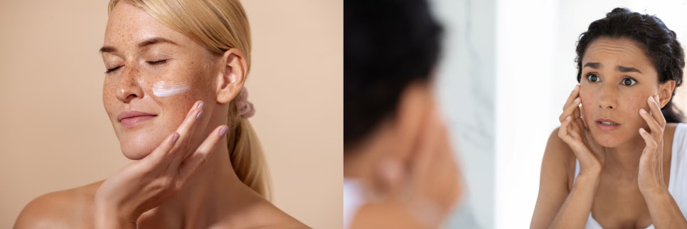 모공줄이는시술 늘어난 모공 작아질 수 있을까? 관련 이미지 4