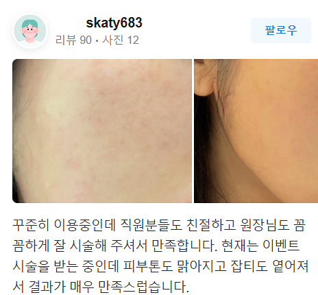 써마지 피부관리 좋은 효과를 원한다면 반드시 확인해야 하는 것 관련 이미지 18