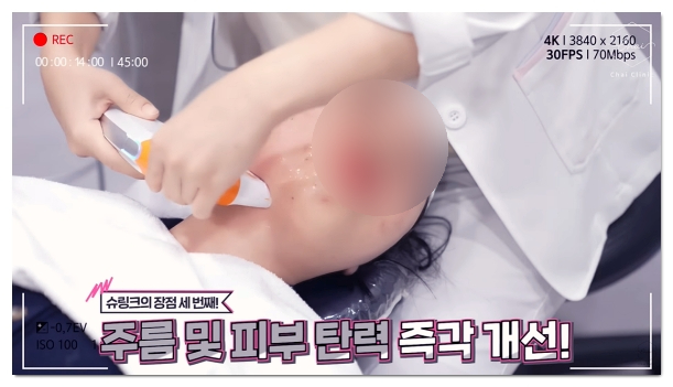 Three Major Side Effects of Hongdae Shurink and How to Fix Them image 2