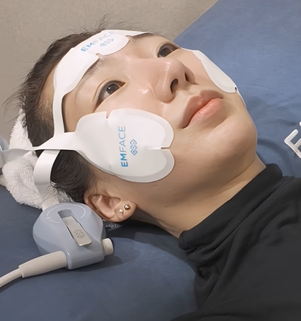 How to Reduce the Midface with EMFACE: A Midface Reduction Procedure image 7