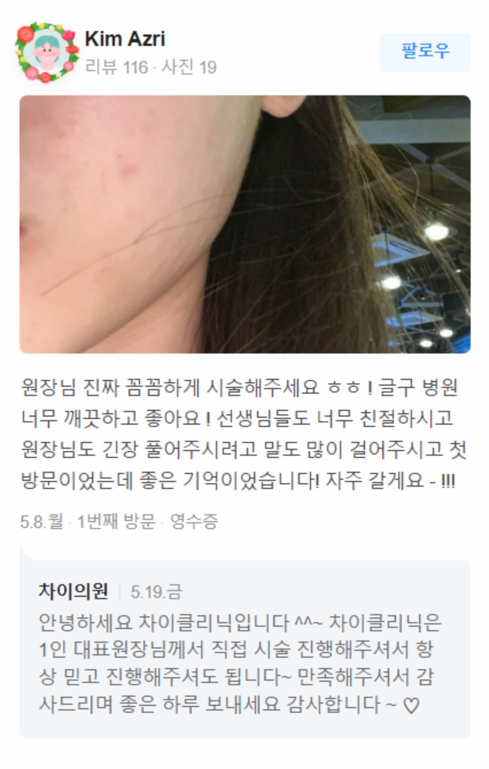 눈밑꺼짐필러로 볼륨UP과 동시에 다크서클까지 해결 관련 이미지 12