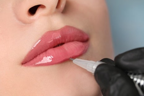 합정 입술필러잘하는곳 자연스러운 볼륨업을 원하시나요? 관련 이미지 2
