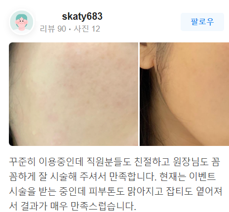 피부색소침착레이저 뽀샵한 듯 말끔한 얼굴의 비법 관련 이미지 14