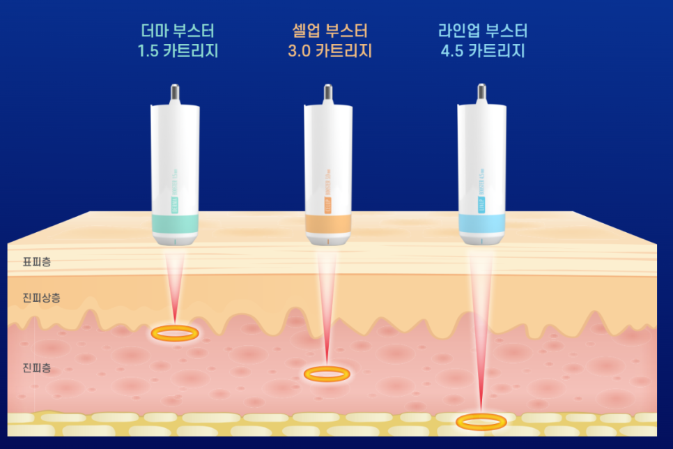 Hongdae Shurink: Take Care of Summer Heatwave Skin Damage in Just 20 Minutes image 12