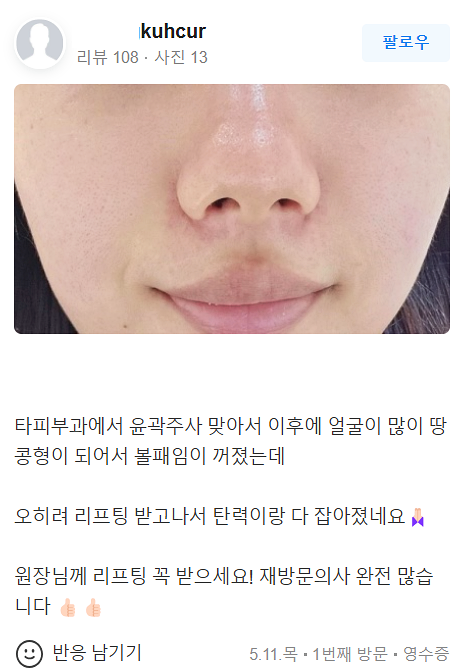 써마지 피부관리 좋은 효과를 원한다면 반드시 확인해야 하는 것 관련 이미지 19