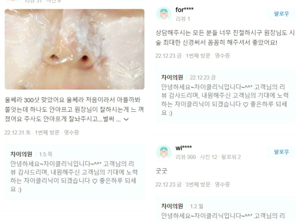 레이저리프팅 관련 이미지 15