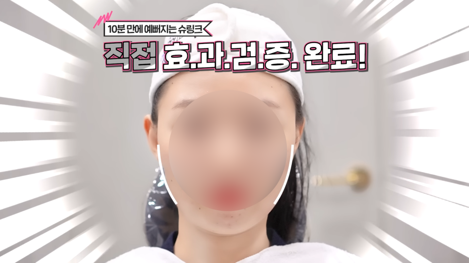 합정 슈링크 원리 효과 울쎄라보다 오래갈까? 관련 이미지 5