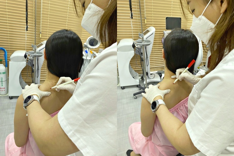 합정 승모근 관리 갖고싶다! 예쁜 직각 어깨 관련 이미지 4