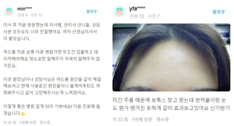 눈리프팅 효과를 120% 더 낼 수 있는 시술 대공개! 관련 이미지 16