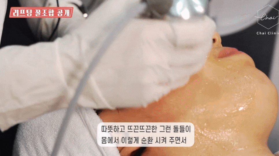 홍대슈링크 리프팅 맛집 찾으세요? 관련 이미지 4