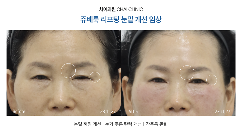 쥬베룩 효과 시기를 제대로 보기 위해선 관련 이미지 4